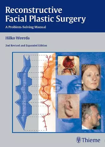 Reconstructive Facial Plastic Surgery cover
