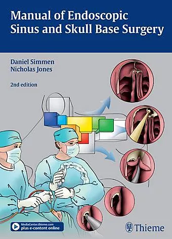 Manual of Endoscopic Sinus and Skull Base Surgery cover