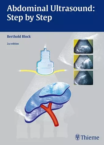 Abdominal Ultrasound: Step by Step cover