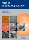 Atlas of Fundus Angiography cover