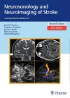 Neurosonology and Neuroimaging of Stroke cover