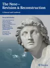 The Nose - Revision and Reconstruction cover