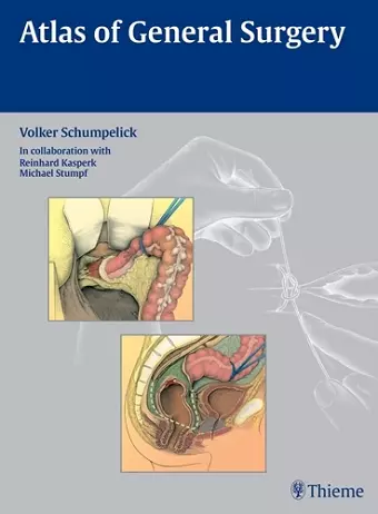 Atlas of General Surgery cover