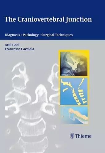 The Craniovertebral Junction cover