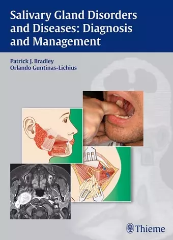 Salivary Gland Disorders and Diseases: cover