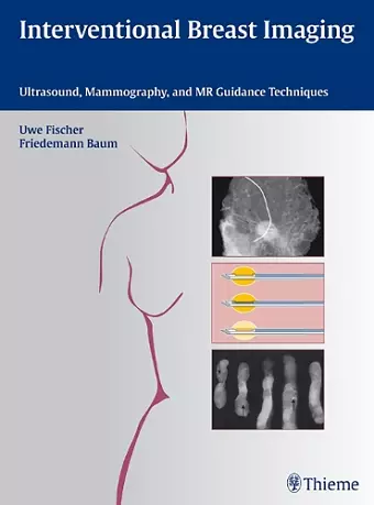 Interventional Breast Imaging cover