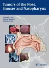 Tumors of the Nose, Sinuses and Nasopharynx cover