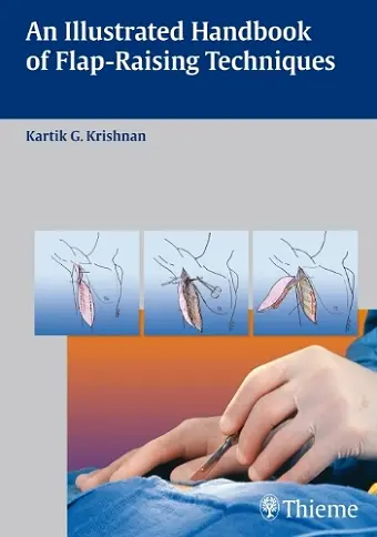 An Illustrated Handbook of Flap-Raising Techniques cover