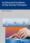 An Illustrated Handbook of Flap-Raising Techniques cover