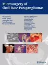 Microsurgery of Skull Base Paragangliomas cover