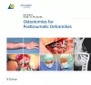 Osteotomies for Posttraumatic Deformities cover