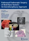 Endonasal Endoscopic Surgery of Skull Base Tumors: An Interdisciplinary Approach cover