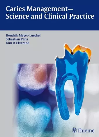 Caries Management - Science and Clinical Practice cover