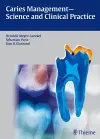 Caries Management - Science and Clinical Practice cover