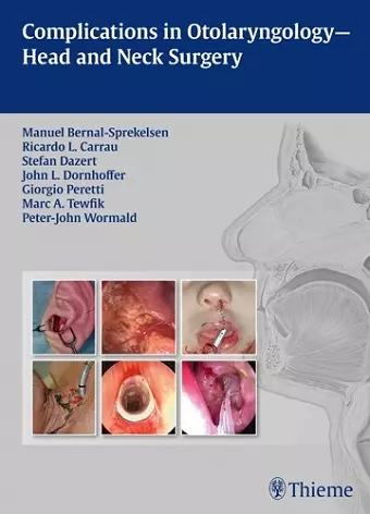 Complications in Otolaryngology - Head and Neck Surgery cover