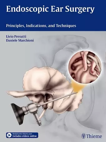 Endoscopic Ear Surgery cover