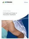 Concepts and Cases in Nonunion Treatment cover