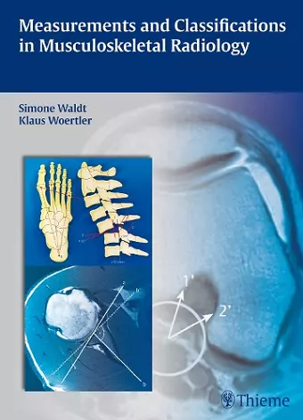 Measurements and Classifications in Musculoskeletal Radiology cover