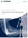 Periprosthetic Fracture Management cover