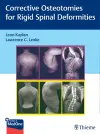 Corrective Osteotomies for Rigid Spinal Deformities cover