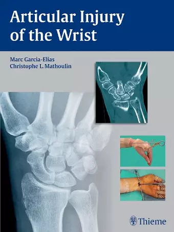 Articular Injury of the Wrist cover