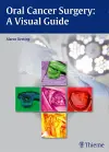 Oral Cancer Surgery cover