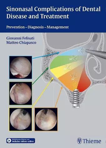 Sinonasal Complications of Dental Disease and Treatment cover