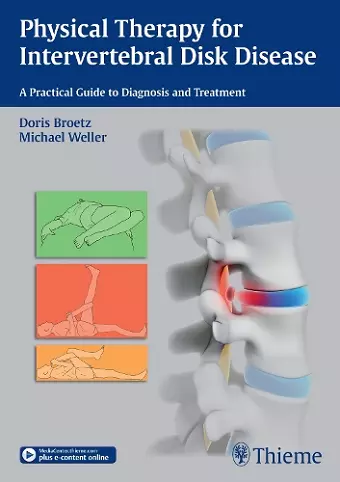 Physical Therapy for Intervertebral Disk Disease cover