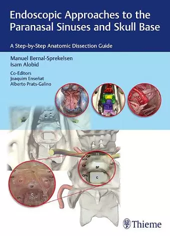 Endoscopic Approaches to the Paranasal Sinuses and Skull Base cover