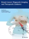Breast Cancer: Diagnostic Imaging and Therapeutic Guidance cover