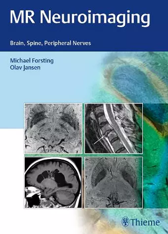 MR Neuroimaging cover