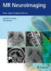 MR Neuroimaging cover