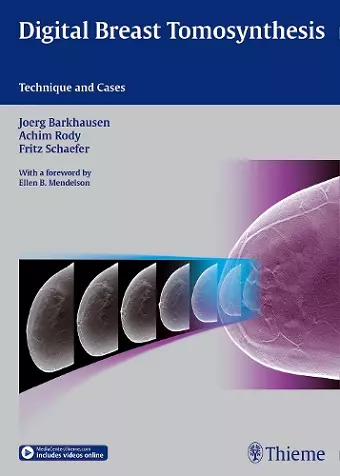 Digital Breast Tomosynthesis cover