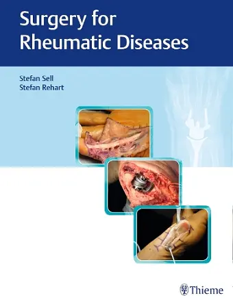 Surgery for Rheumatic Diseases cover