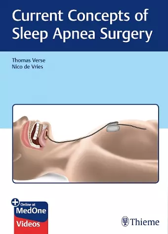 Current Concepts of Sleep Apnea Surgery cover