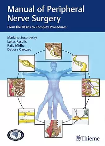 Manual of Peripheral Nerve Surgery cover