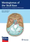 Meningiomas of the Skull Base cover