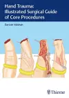 Hand Trauma: Illustrated Surgical Guide of Core Procedures cover