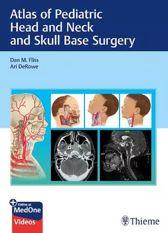 Atlas of Pediatric Head and Neck and Skull Base Surgery cover