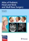 Atlas of Pediatric Head and Neck and Skull Base Surgery cover