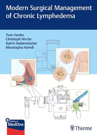 Modern Surgical Management of Chronic Lymphedema cover