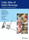 Color Atlas of Endo-Otoscopy cover