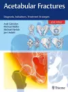 Acetabular Fractures cover