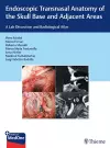 Endoscopic Transnasal Anatomy of the Skull Base and Adjacent Areas cover