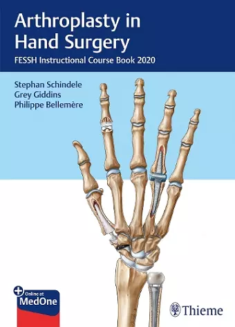 Arthroplasty in Hand Surgery cover