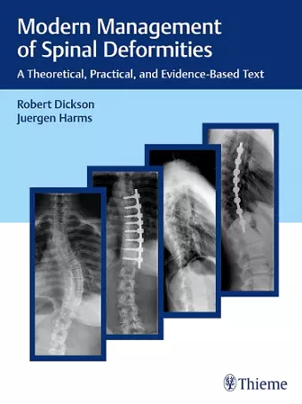 Modern Management of Spinal Deformities cover