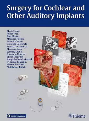 Surgery for Cochlear and Other Auditory Implants cover