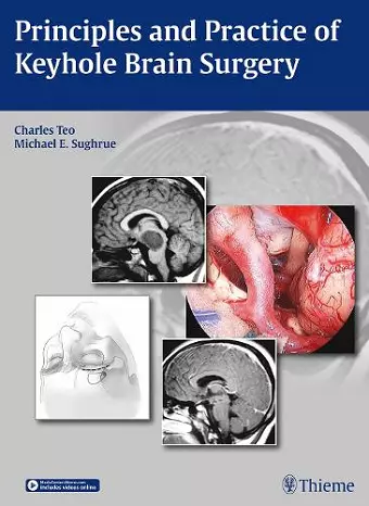 Principles and Practice of Keyhole Brain Surgery cover