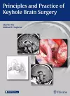 Principles and Practice of Keyhole Brain Surgery cover