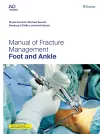 Manual of Fracture Management - Foot and Ankle cover